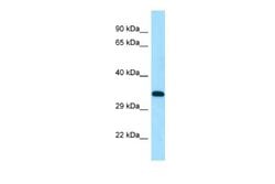 DSN1 Antibody, Novus Biologicals 100 &mu;L | Buy Online | Novus Biologicals | Fisher Scientific